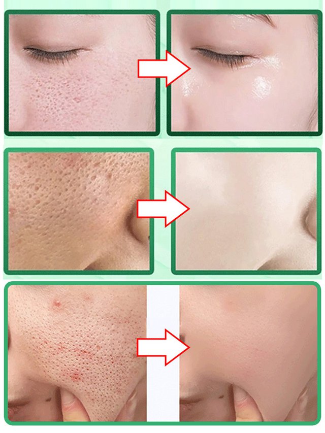 Maska bąbelkowa trawy śnieżnej