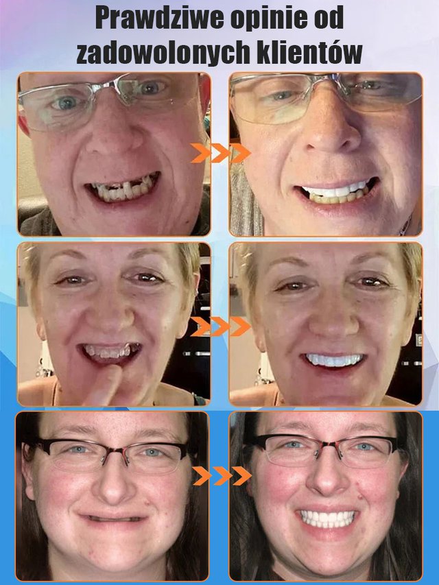 【Nowe odkrycie brytyjskich naukowców】Proteza zębowa z silikonu