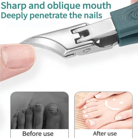 🔥Unghiere recomandate de podiatri 🛡️ - Design ergonomic înclinat pentru unghii de la picioare și unghii încarnate